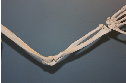 윤활낭염 주요 원인