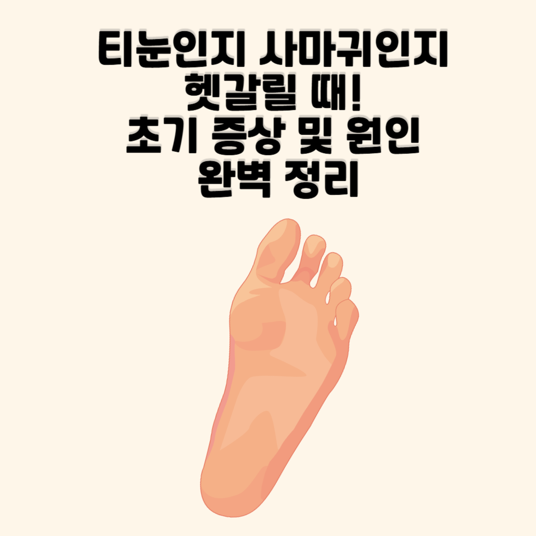 티눈인지 사마귀인지 헷갈릴 때! 초기 증상 및 원인
