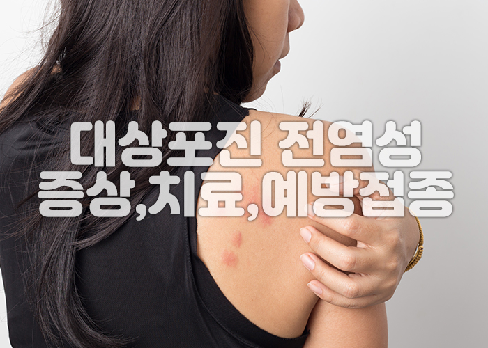 한여성이 대상포진으로 인한 가려움으로 등을 긁고있다