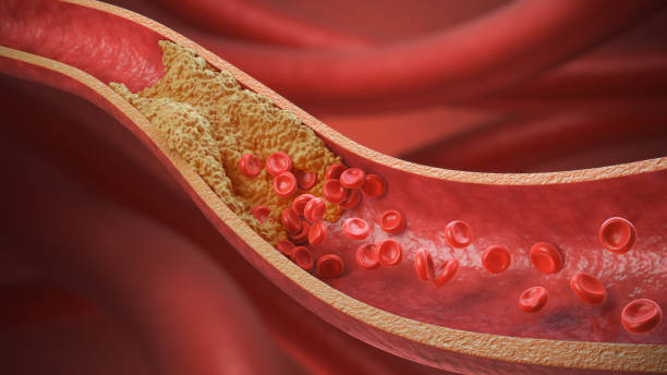 총콜레스테롤 정상수치&amp;#44; LDL/HDL&amp;#44; non-HDL