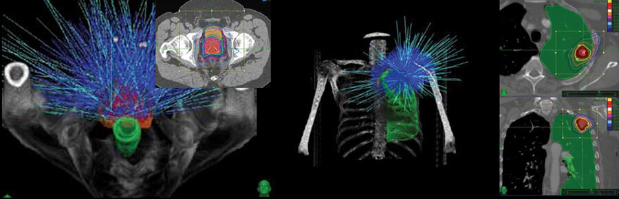 사이버 나이프 (Cyber Knife)