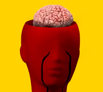 뇌졸중 치료방법 진단 합병증