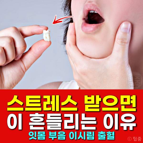 스트레스 받으면 이빨 흔들리는 이유,스트레스 잇몸 부음 이시림 출혈