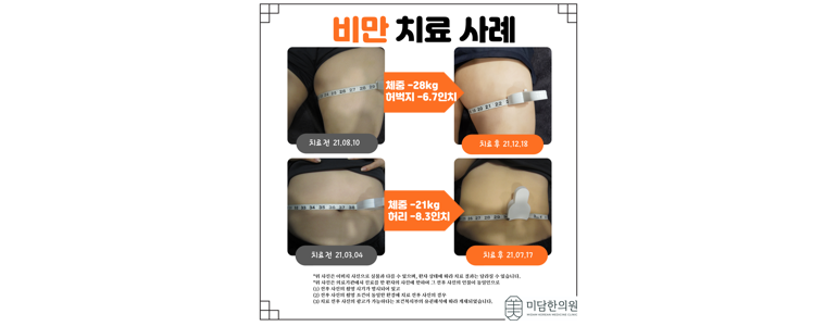 광주 서구 불면증