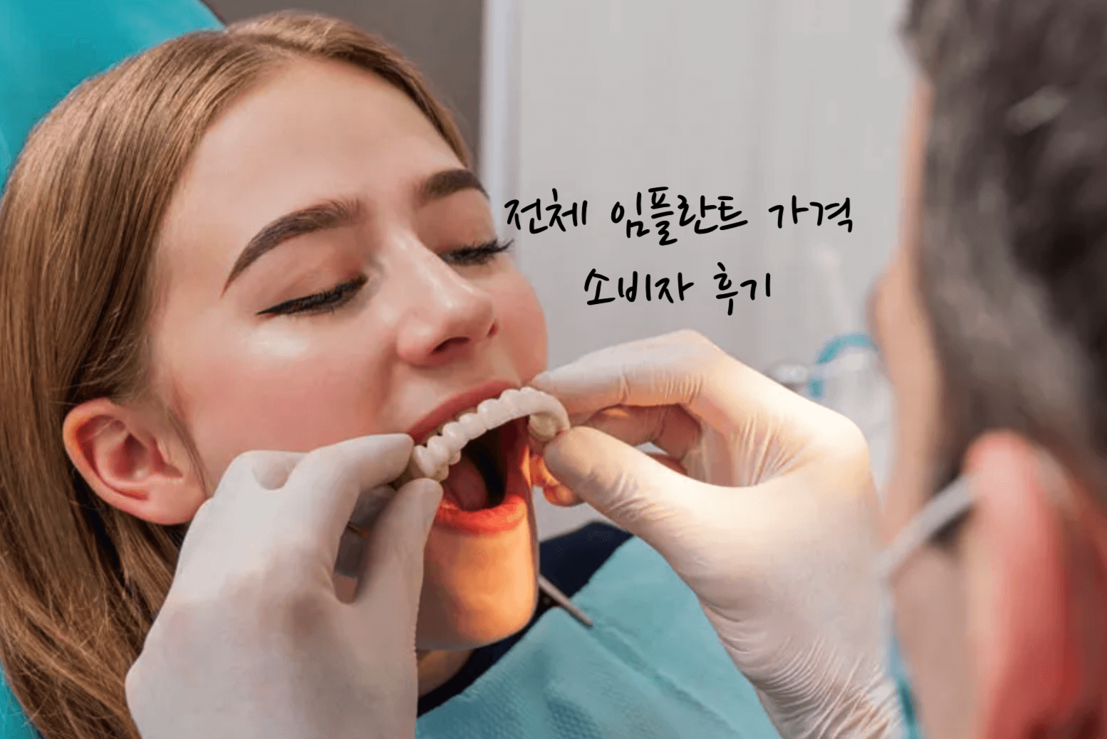전체 임플란트