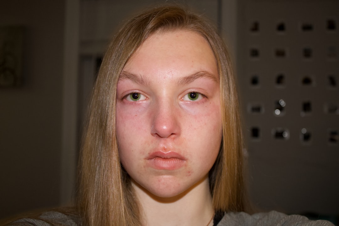Swelling