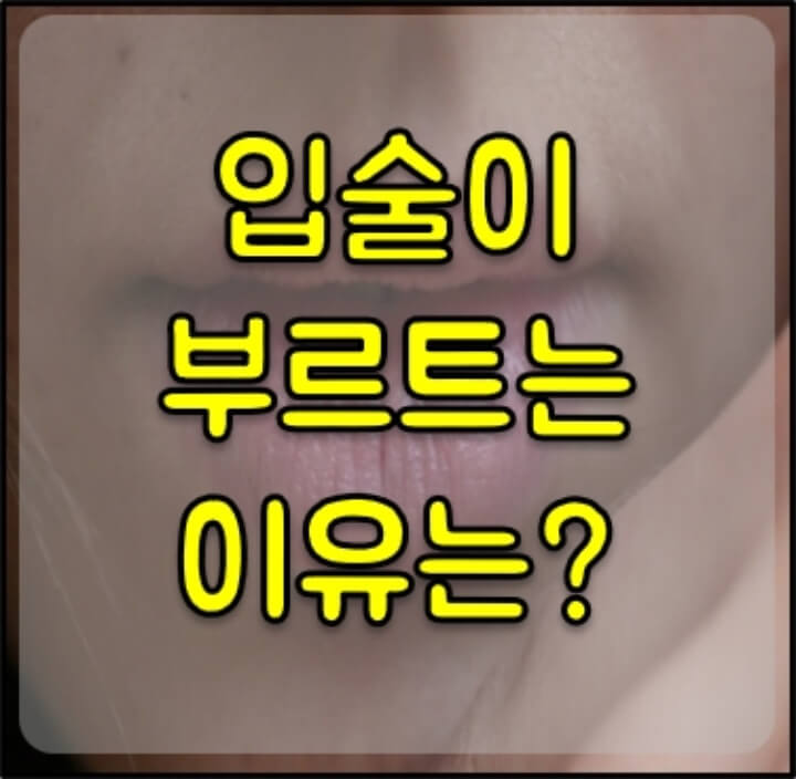 입술이 부르트는 이유 썸네일
