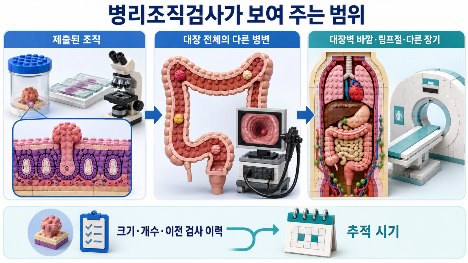 제출된 조직과 대장 전체의 다른 병변, 대장벽 바깥·림프절·다른 장기를 병리검사·내시경·영상검사로 평가하는 범위