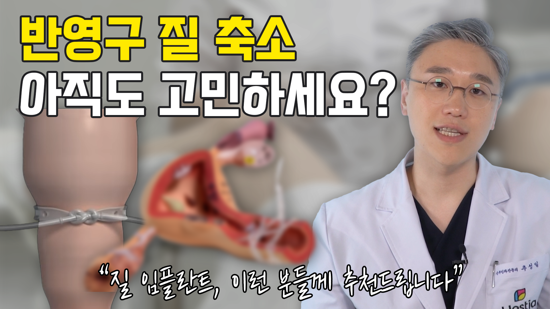 산부인과에 질임플란트? 반영구 질축소를 원한다면!