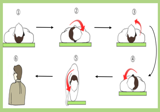 이석증 자가치료법 -수평 반고리관 이석증 치료법