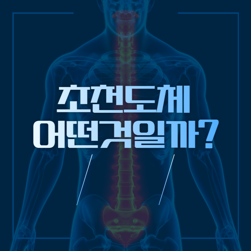 초천도체_1