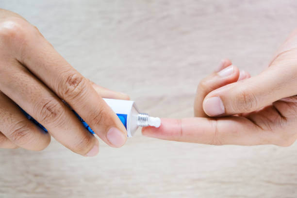 에스로반 연고 효능&amp;#44; 여드름&amp;#44; 무피로신&amp;#44; 에스로반 연고는 일반의약품이며 약국에서 쉽게 구매할 수 있습니다. 일반적으로 가정에 연고 하나씩은 있는데 후시딘&amp;#44; 마데카솔&amp;#44; 에스로반&amp;#44; 베아로반 등 입니다. 에스로반이 여드름에도 효과가 있다고 하는데 글을 참고하시기 바랍니다. 