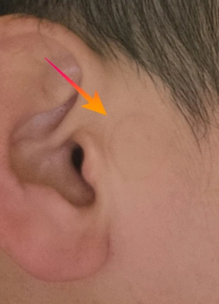 레노버 골전도 이어폰 X4 자국 남음