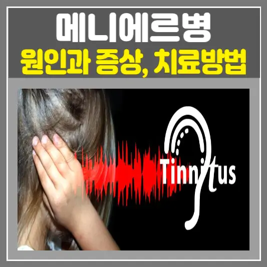 메니에르병 원인과 증상 그리고 치료방법 총정리
