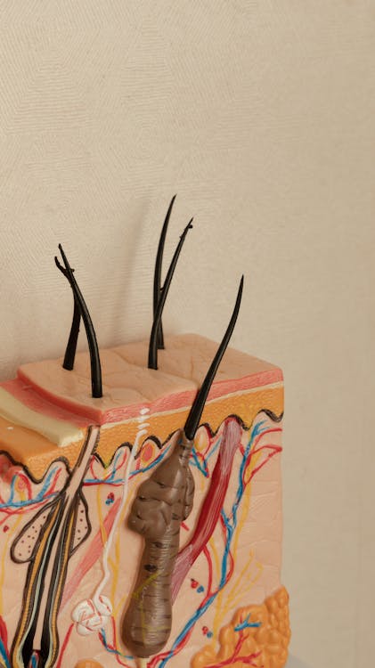 탈모 관련 사진