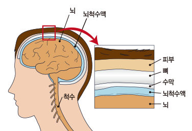 뇌수막염 증상부터 원인, 치료까지