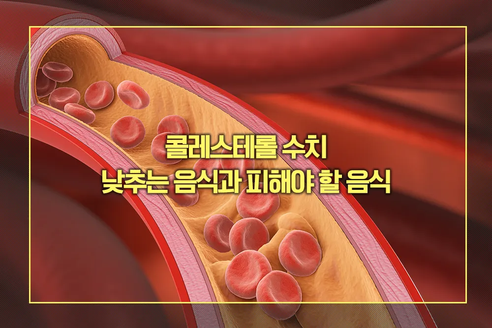 콜레스테롤 수치 낮추는 음식