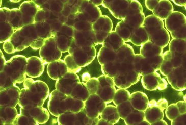 엠폭스-백신-관련주