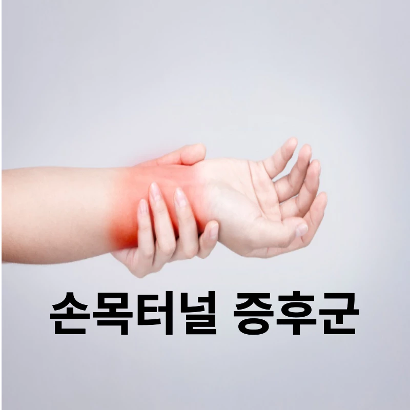 손목터널-증후군-증상-예방법-치료법