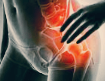 고관절 통증 증상