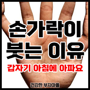 손가락이 붓는 이유