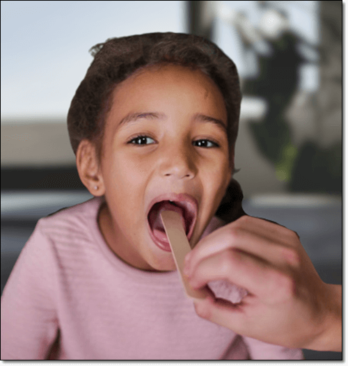 소아 역류성 인후두염 환자