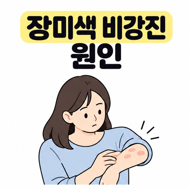 장미색 비강진 원인 제목 아래 팔에 생긴 옅은 타원형 반점을 살펴보는 사람의 대표 이미지
