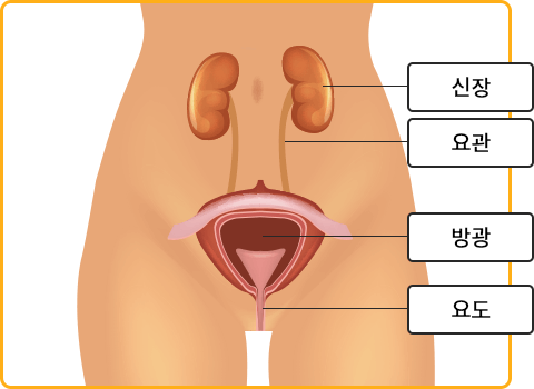 요실금 치료방법, 요실금 수술 비용, 요실금 팬티, 요실금 치료기 추천, 요실금 병원