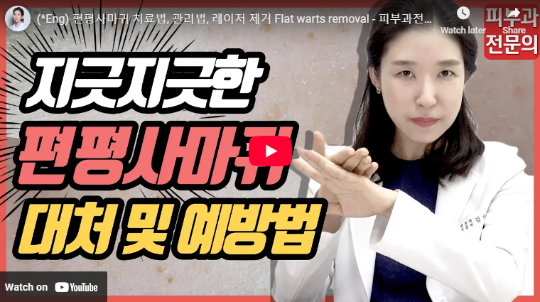 편평사마귀 얼굴 제거 레이저 비용 원인 치료