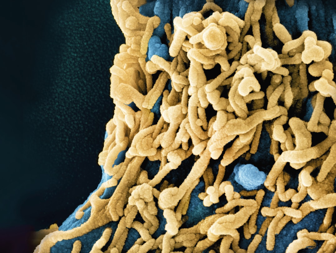 Infectious disease