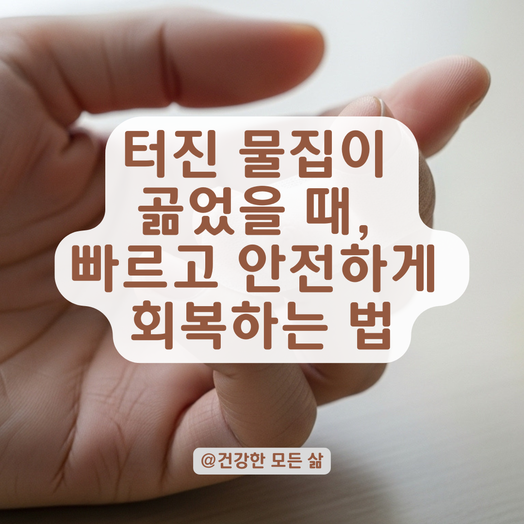 터진 물집이 곪었다면? 감염 막고 빠르고 안전하게 회복하는 관리법 정리.