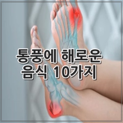 통풍에 해로운 음식 10가지