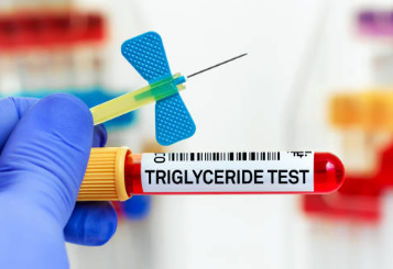 중성지방 낮추는 방법, 중성지방 정상수치