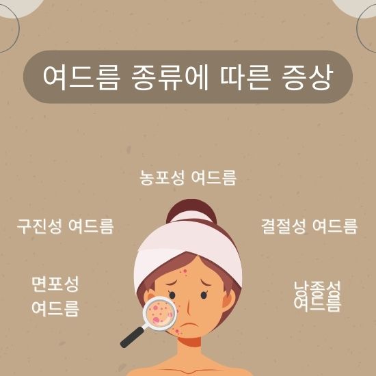 여드름 종류에 따른 증상
