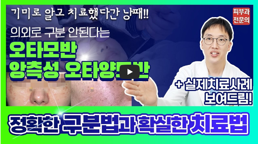 유튜브 오타모반