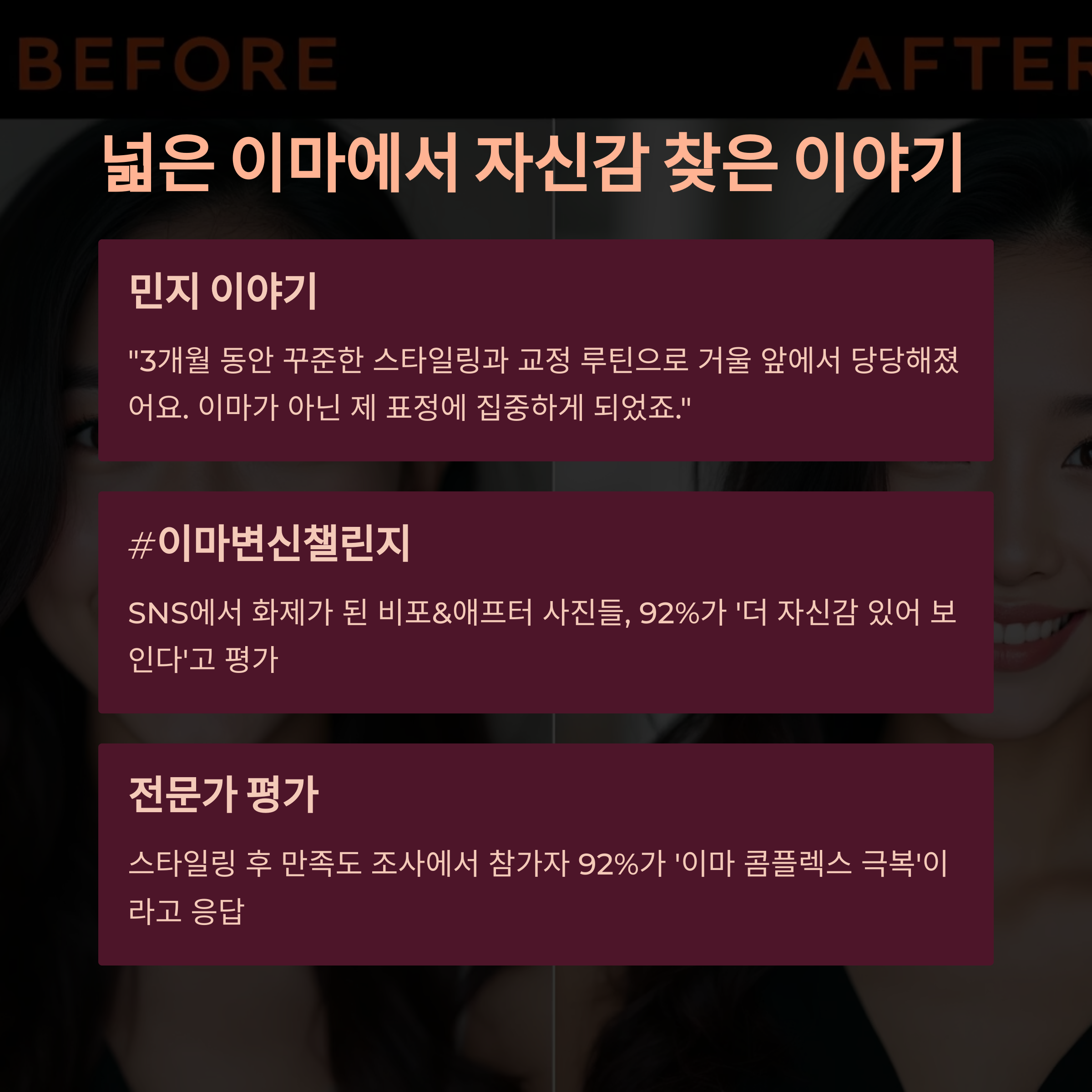 넓은 이마에서 자신감 찾은 이야기