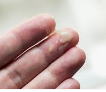 가래가 생기는 원인 알아보기