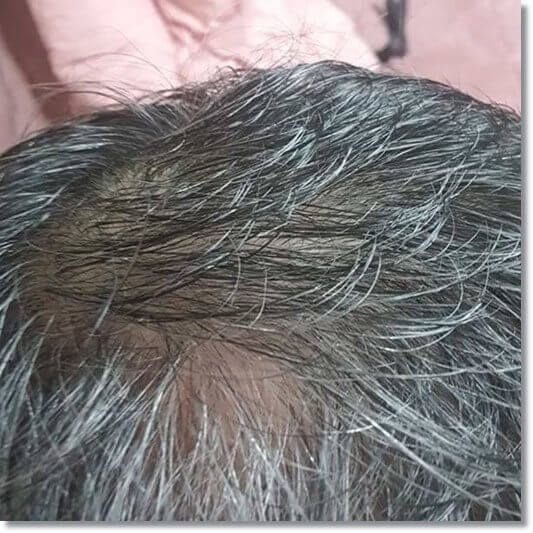 고구마 잎의 효능 모발 건강