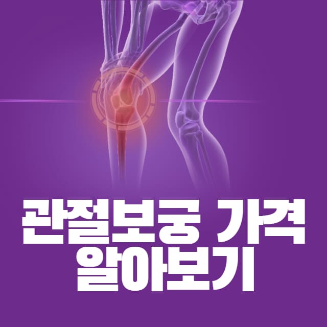관절보궁 가격