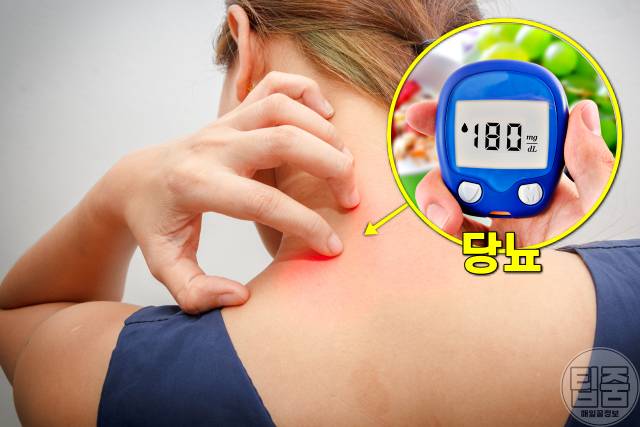 피부가 가려운 이유 당뇨병,가려움증 원인