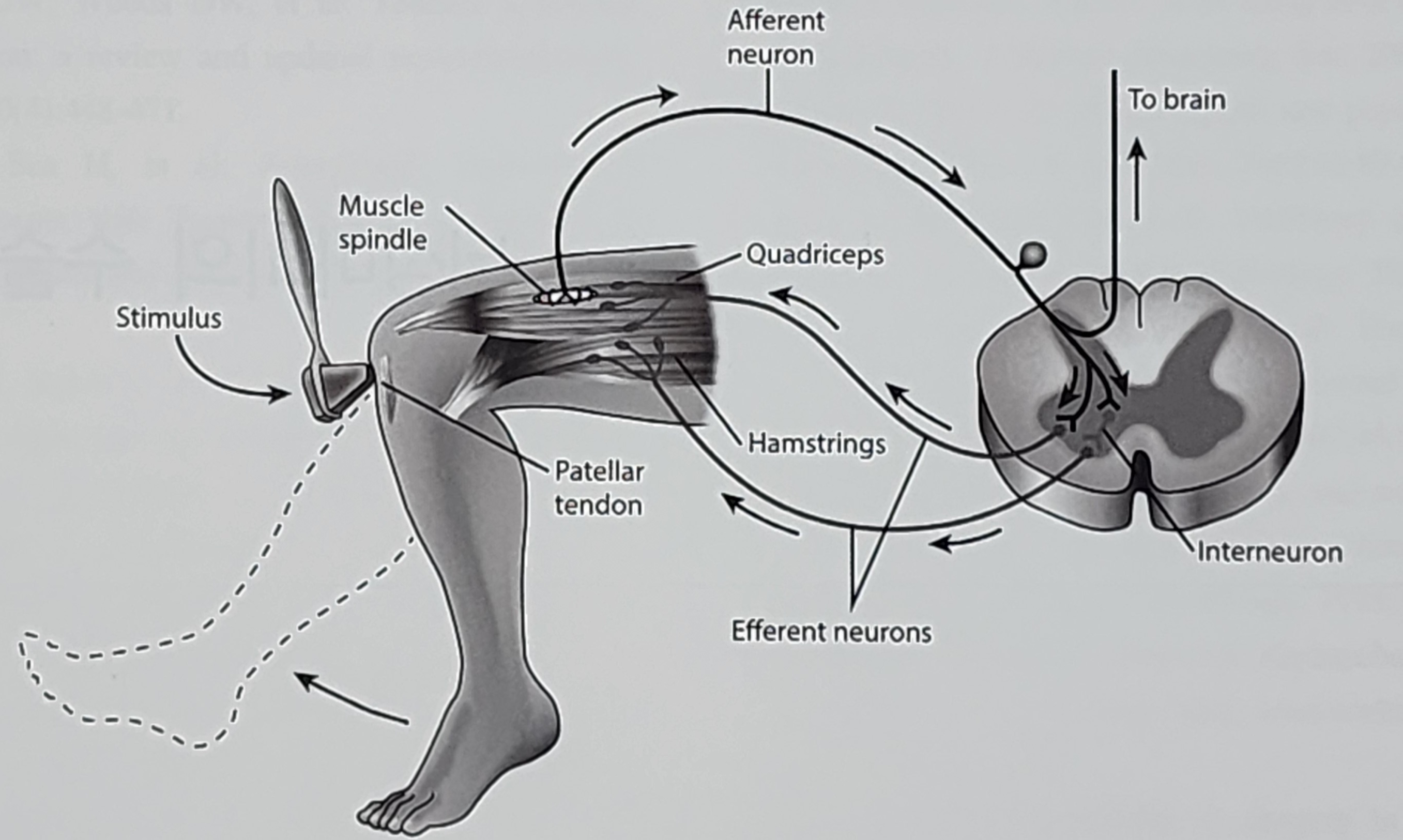 뇌성마비의 수술적 치료 1