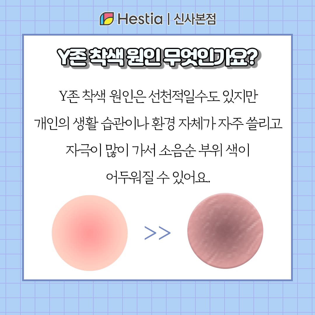 Y존 착색 원인 무엇인가요?