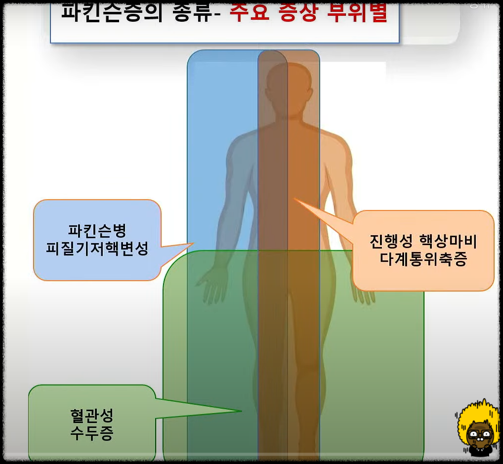 증상의 부위별로 분류하는 파킨슨증 환자
