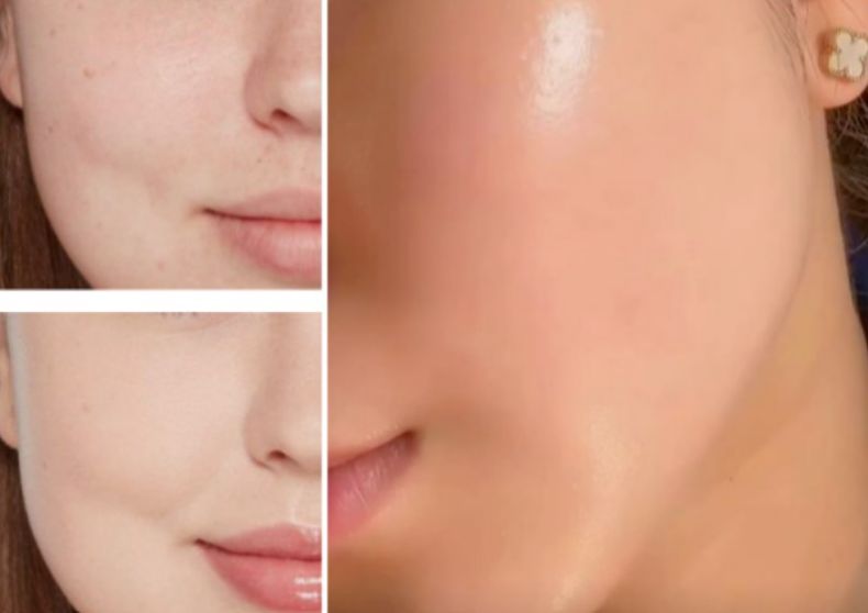 마데카크림 효과-봄 황사, 미세먼지 민감피부