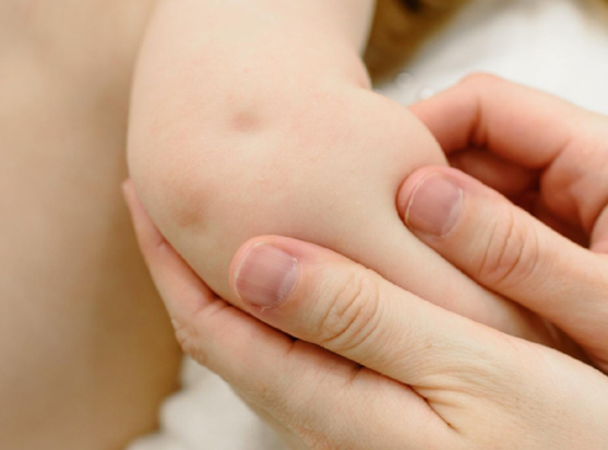 한 어린이집 선생님이 모기 때문에 학부모에게 민원을 제기 받았다는 사연이 전해지면서 누리꾼들의 갑론을박이 이어졌다. 본 기사와 무관한 이미지. [사진=pexels]