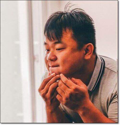 표피낭종 짜는 남성