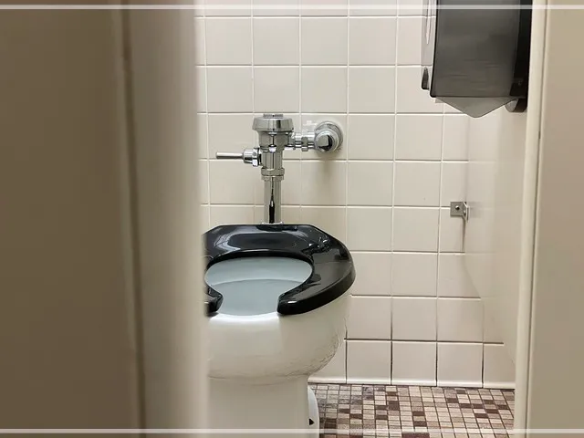 전립선-비대증-치료-비뇨기과-남성수술