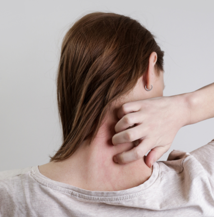 목-긁고있는-여성