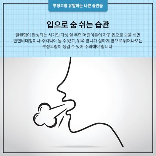 치아 부정교합 원인