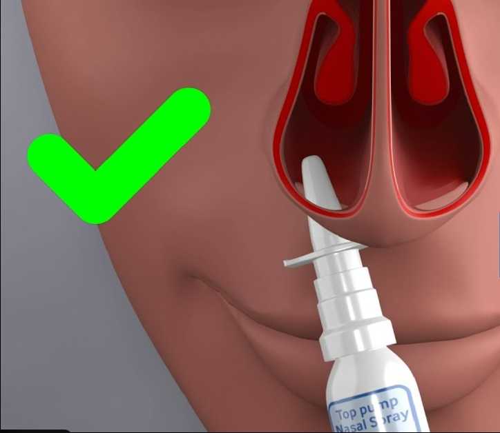 스프레이 사용, 비염